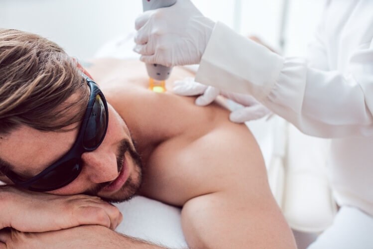 Can Men Get Laser Hair Removal