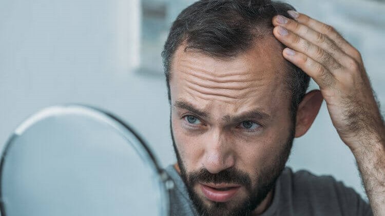 Reasons For Hair Loss in Men